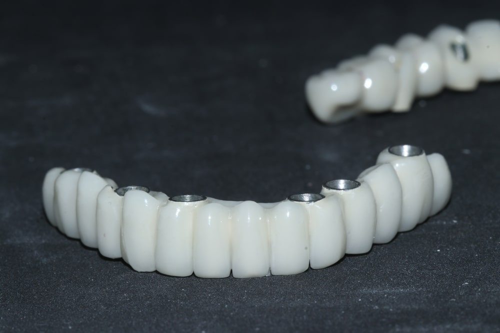 implant-supported dentures kingsport